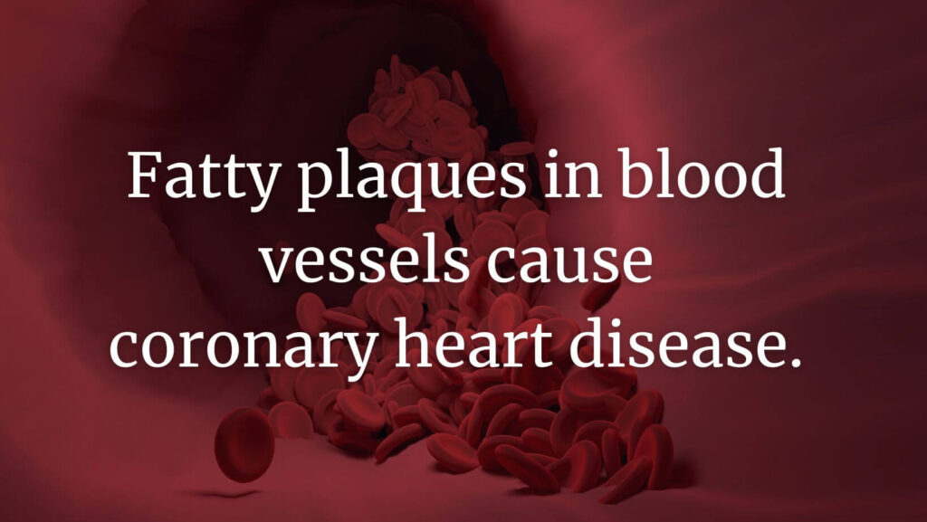 Fatty plaques in blood vessels cause coronary heart disease.